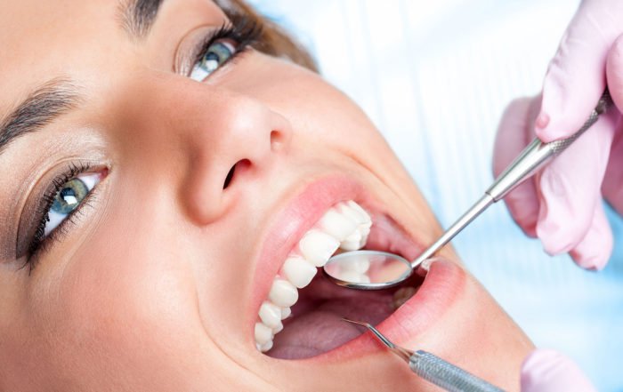 Revisión bucal de dentista