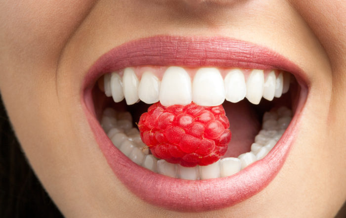 alimentos_que_manchan_dientes