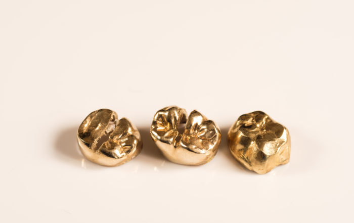 deintes_oro_grill